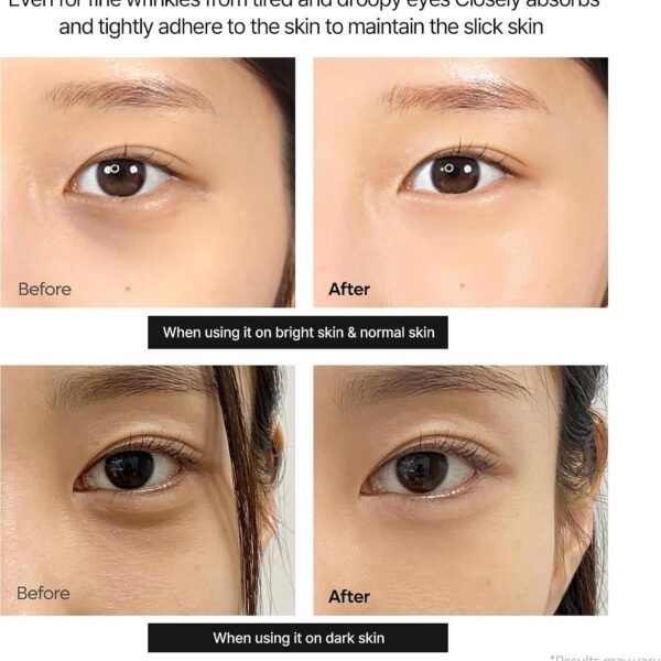 Calcium hydrogel eye patches for dark circles in Dubai